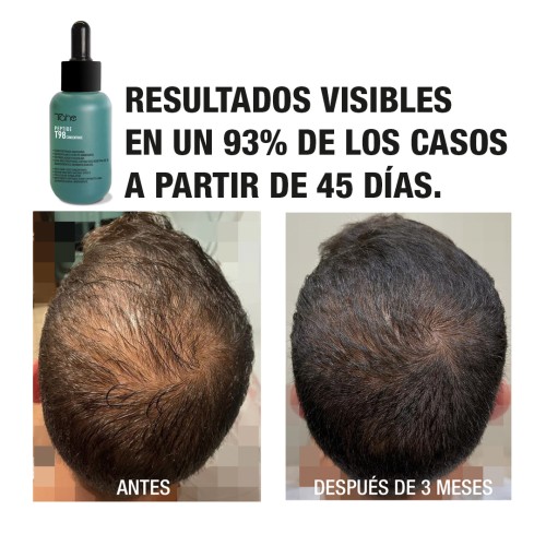 peptide t98 concentrado anticaida 50ml tahe 106788 500x500